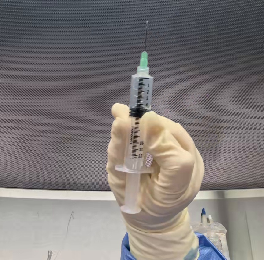 Center Diluent-filled syringe
